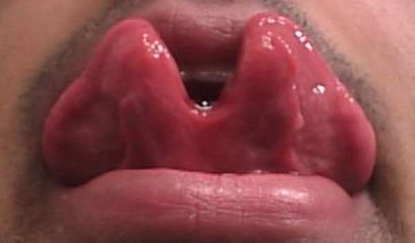 Vemos la perforacion de la lengua que la cortaron desde su base hasta  el fondo de ella