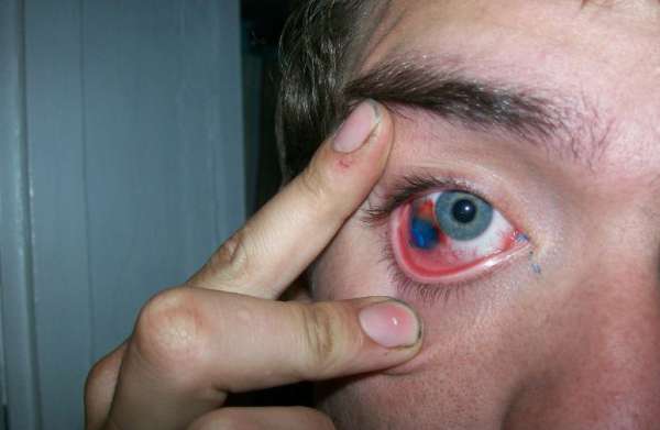 Vemos auna persona con un ojo de color azul que  le miran un tatuaje que tiene dentro del ojo